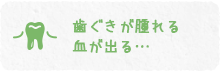 歯ぐきが腫れる 血が出る…